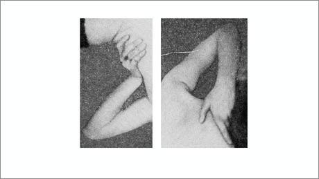 Image comprising two black and white photographs showing a hand and part of a body